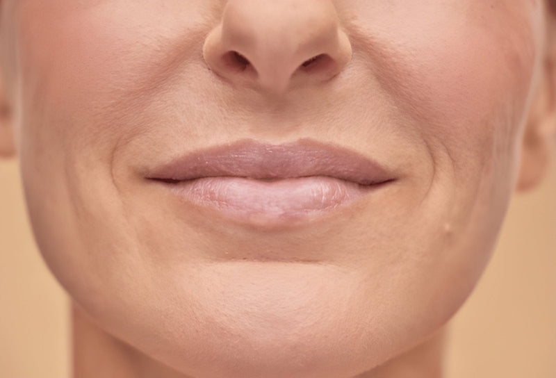 How to Get Rid of Smile Lines: Causes, Treatments and Prevention
