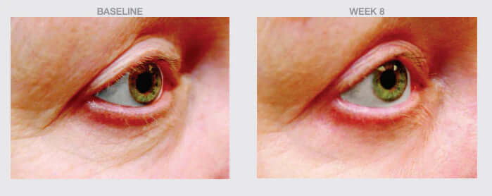 Smooth Eye Firm & Brighten Peptide Cream-The Skin Spot