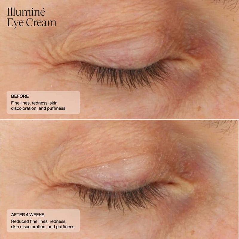 Sente- Illumine Eye Cream-The Skin Spot