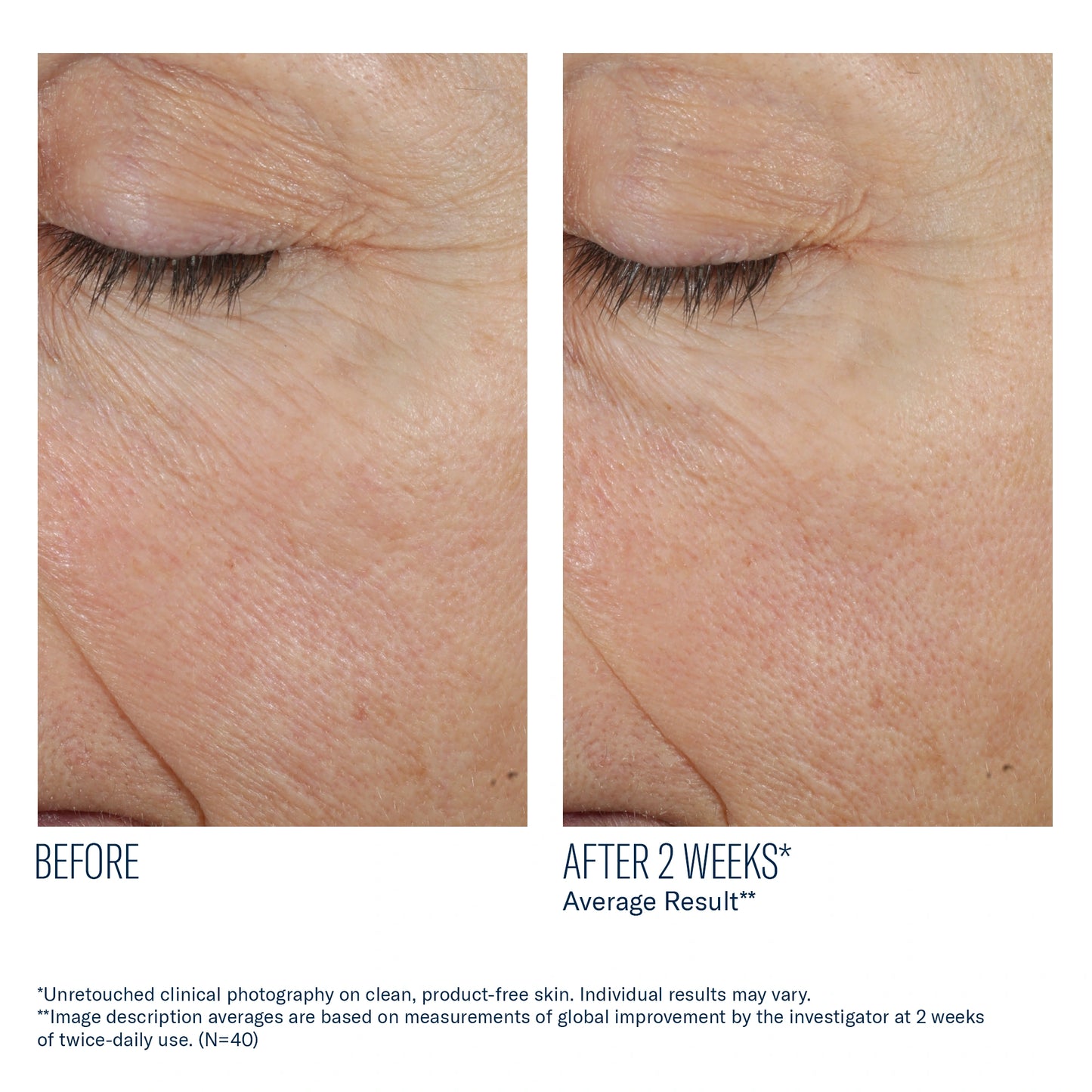 Before and after 2 weeks using SkinBetter Science Trio Rebalancing Moisture Treatment showing smoother hydrated skin