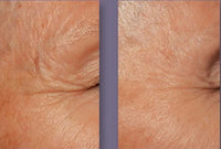 DefenAge- 3D Eye Radiance Cream before and after