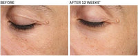 Revision Skincare- Revox Line Relaxer before and after