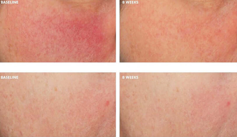 SkinCeuticals- Glycolic 10 Renew Overnight-The Skin Spot