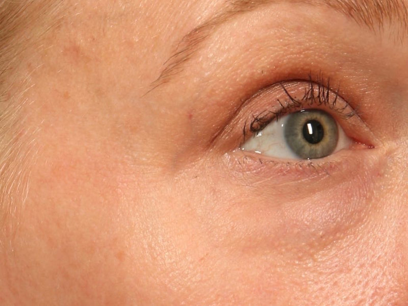 SkinMedica- TNS Eye Repair-The Skin Spot