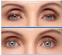 UPNEEQ® Eye Opening Drops before and after
