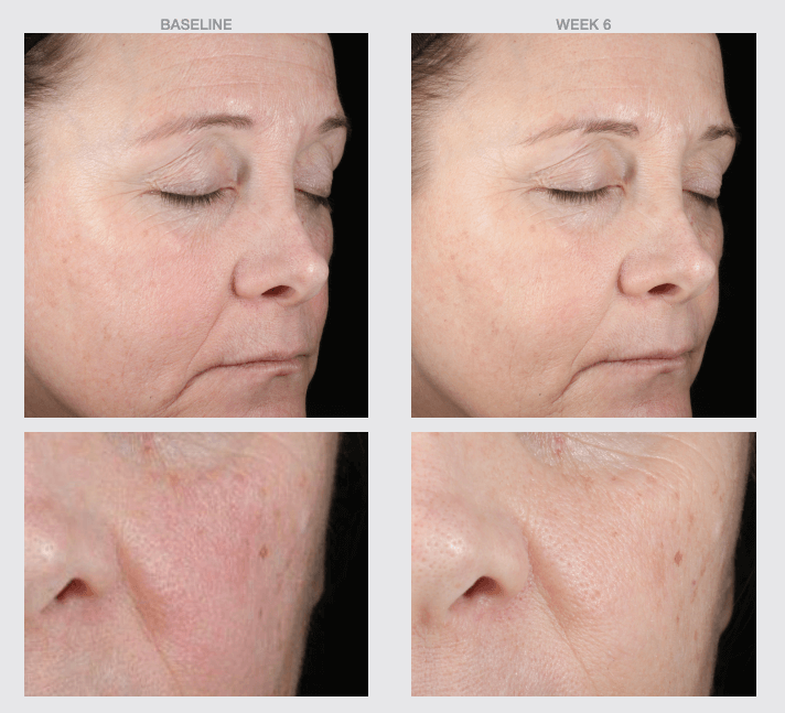 HA Boost Hydrating Copper Firming Serum-The Skin Spot