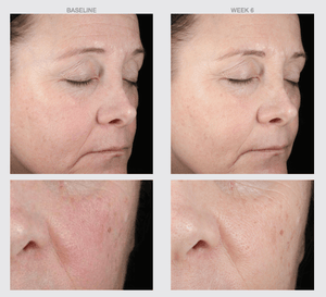 HA Boost Hydrating Copper Firming Serum-The Skin Spot