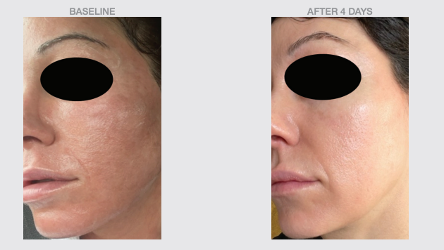 Phyto Balance Antioxidant Soothing Serum-The Skin Spot