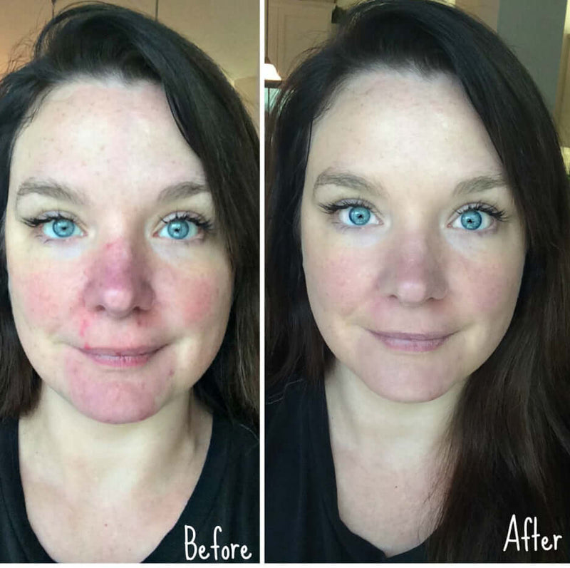 Revision Skincare- Gentle Cleansing Lotion-The Skin Spot