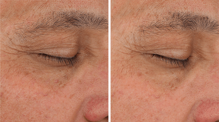 Sente- Illumine Eye Cream-The Skin Spot