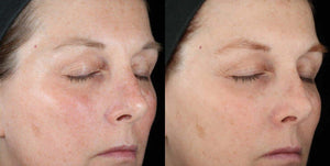 SkinCeuticals- Metacell Renewal B3-The Skin Spot