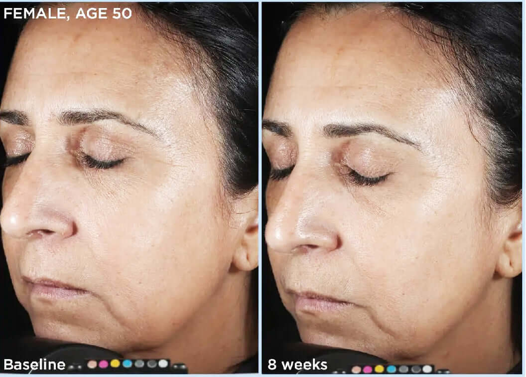 SkinMedica- HA5 Rejuvenating Hydrator-The Skin Spot