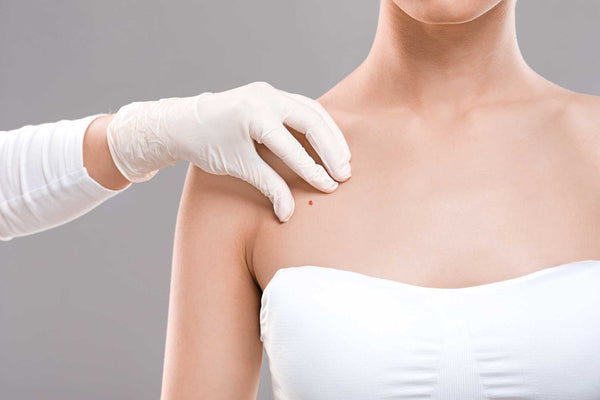 What Are Skin Lesions? Causes and Warning Signs