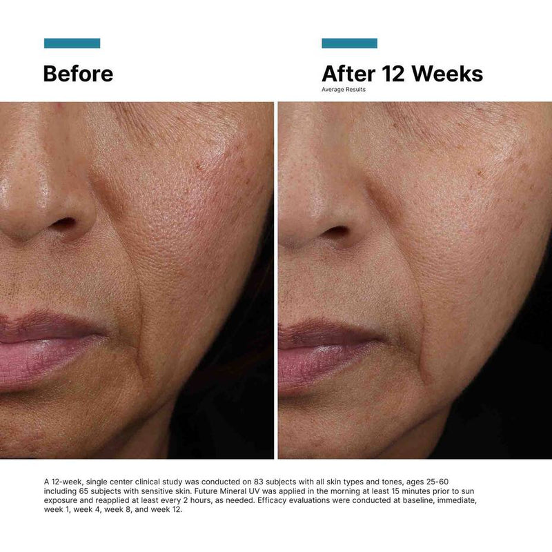 SkinCeuticals Future Mineral UV Defense