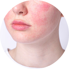 Sensitive Skin