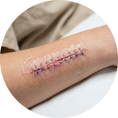 Surgical Recovery