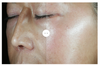 Sente- Dermal Repair Ultra-Nourish