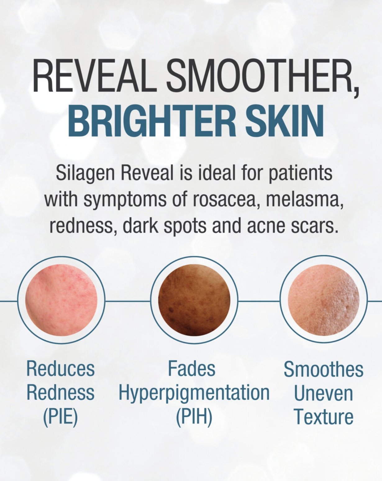 Silagen Reveal Scar & Acne Mark Refinement Gel