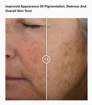 Alastin A-Luminate Brightening Serum before and after showing reduced dark spots improved skin tone and brighter complexion
