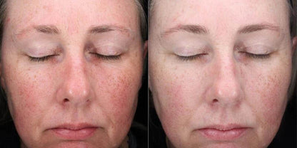 alastin c-radical defense antioxidant serum before and after results showing improved skin appearance