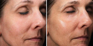 alastin c radical defense antioxidant serum before and after showing smoother skin texture and improved appearance
