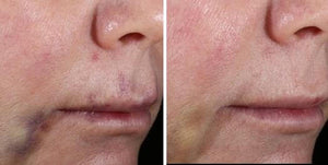 Alastin Skincare- INhance Post-Injection Serum-The Skin Spot