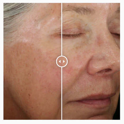 Before and after using Alastin ReSurface Skin Polish by Alastin Skincare showing smoother skin texture and improved tone