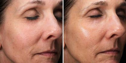 Before and after using Alastin C-Radical Defense Serum, improved skin texture and radiance