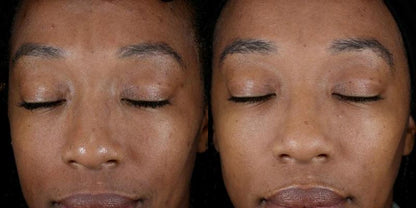 Before and after using Alastin Skincare Renewal Retinol 0.25, smoother skin and reduced fine lines