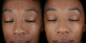 Alastin Skincare Renewal Retinol 0.5 before and after results showing smoother skin and reduced fine lines