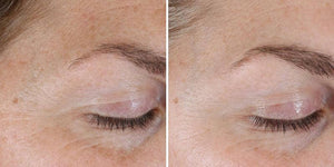 Alastin Skincare- Renewal Retinol .25-The Skin Spot