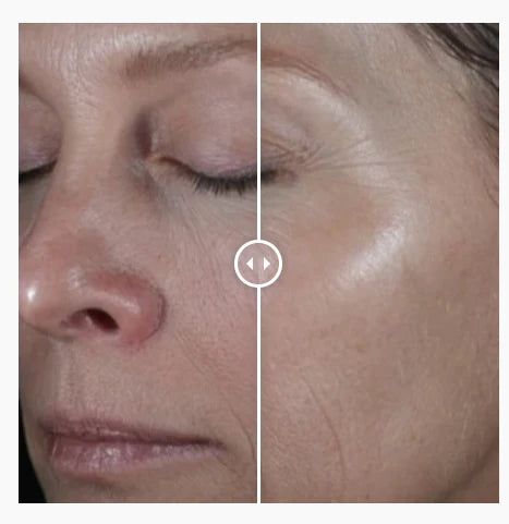 Before and after using Alastin ReSurface Skin Polish, smoother skin texture and enhanced glow