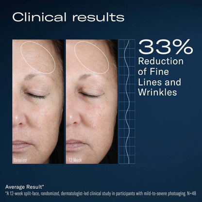AlphaRet Overnight Cream before and after results showing reduced wrinkles and fine lines after 12 weeks use
