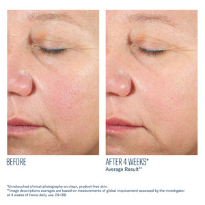 Before and after 4 weeks using Alto Advanced Defense and Repair Serum showing smoother skin texture and reduced redness