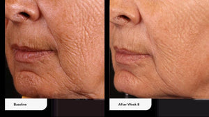 Biojuve- Biome Support Complex-The Skin Spot