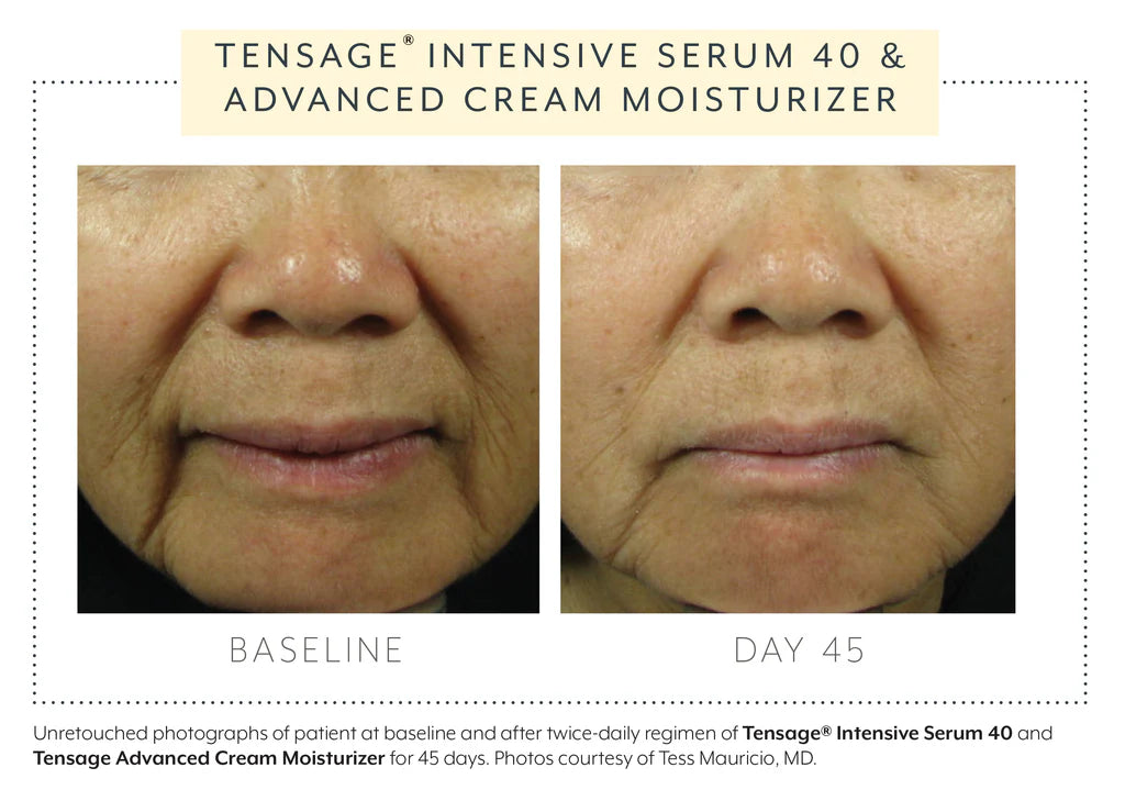 Baseline and Day 45 results using Biopelle Tensage Intensive Serum 40 and Advanced Cream Moisturizer, visible facial rejuvenation