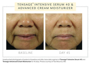 Biopelle Tensage Intensive Serum 40 before and after 45 days — visible improvement in skin tone, texture, and fine lines