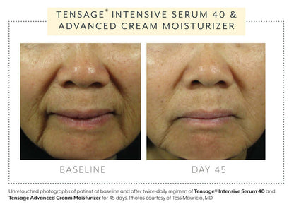 Biopelle Tensage Intensive Serum 40 before and after 45 days — visible improvement in skin tone, texture, and fine lines