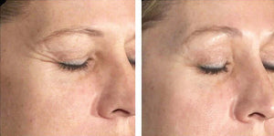 Biopelle Tensage Intensive Serum 40 skin results — brighter, firmer, more even complexion after using SCA BioRepair ampoules