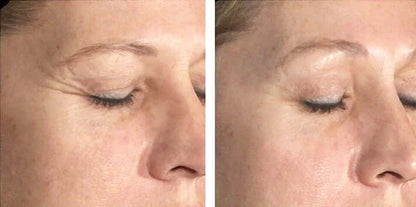 Biopelle Tensage Intensive Serum 40 skin results — brighter, firmer, more even complexion after using SCA BioRepair ampoules