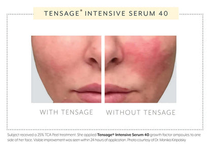 Biopelle Tensage Intensive Serum 40 split-face comparison — 24-hour result showing reduced redness and improved skin radiance