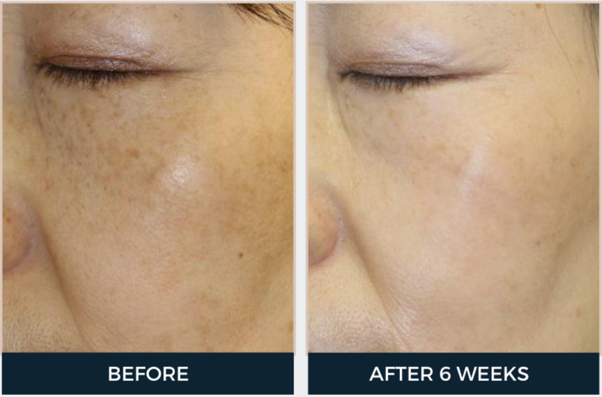 Cyspera Intensive Pigment Corrector & Boost Brightening Booster Cream Duo (2-Piece Set)