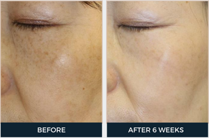 Cyspera Intensive Pigment Corrector & Boost Brightening Booster Cream Duo (2-Piece Set)