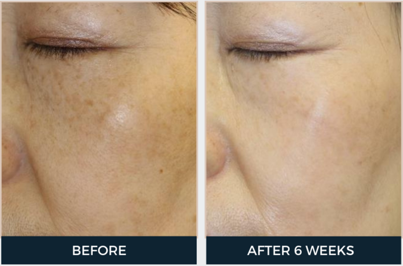 Cyspera Intensive Pigment Corrector & Boost Brightening Booster Cream Duo (2-Piece Set)