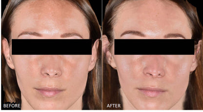 Cyspera Intensive 7 before and after face photo shows uneven skin tone, dark spots and smoother, clearer-looking facial skin