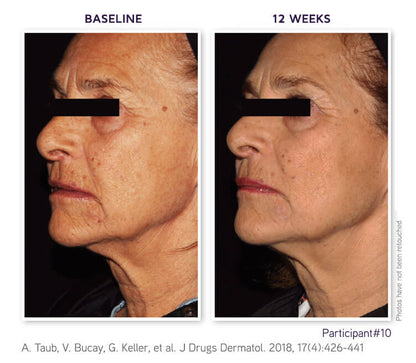 Before and after 12 weeks of using DefenAge Clinical Power Trio Fragrance Free, showing visible anti-aging effects and improved skin texture