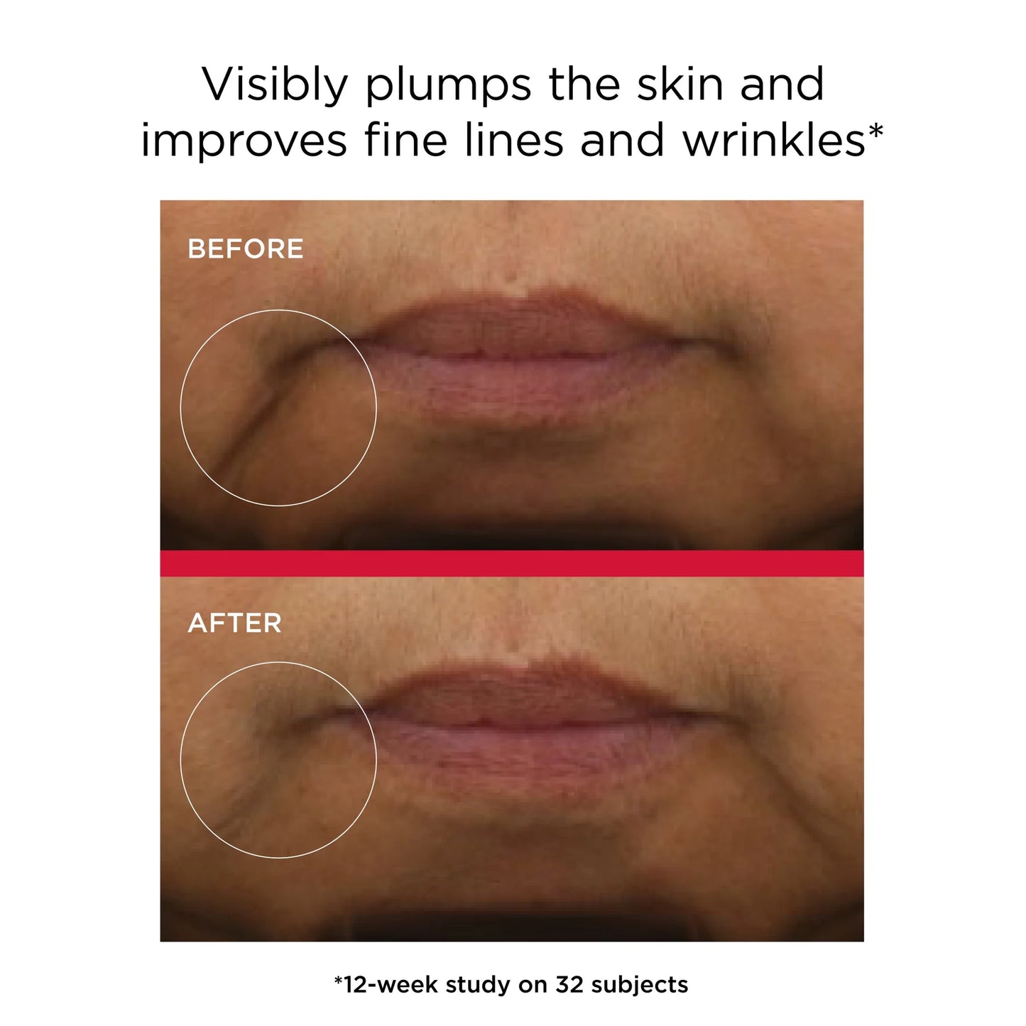 Before and after lip area images showing visibly plumper skin and smoother fine lines with EltaMD UV Hydration+ SPF 50.