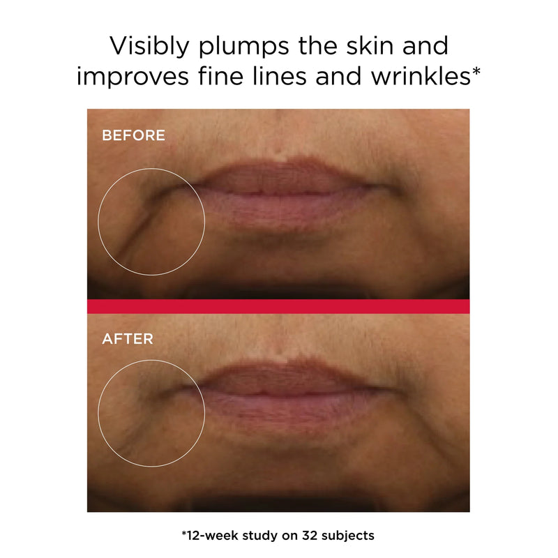 Before and after lip area images showing visibly plumper skin and smoother fine lines with EltaMD UV Hydration+ SPF 50.