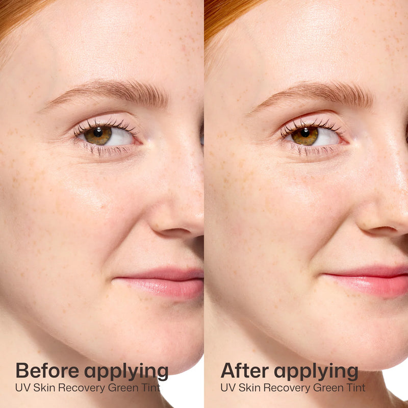Before and after model image showing EltaMD UV Skin Recovery Green Tint reducing visible redness on sensitive skin face