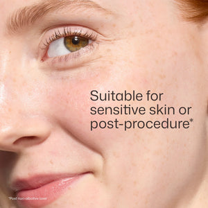 Close-up sensitive skin model image for EltaMD UV Skin Recovery SPF 50 post-procedure mineral sunscreen formula visual card.